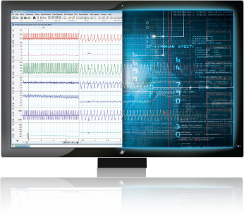 LabChart.