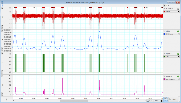 Human Nerve activity data analyzed using LabChart’s RMS Arithmetic feature and the Spike Histogram Add-On
