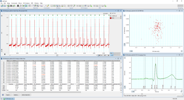 使用LabChart的心电分析模块对人体进行心电记录
