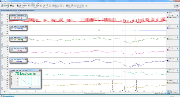 用AdinStruments的人NIBP系统记录血压信号