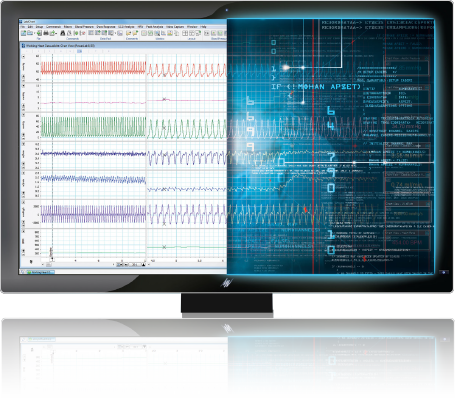 LabChart