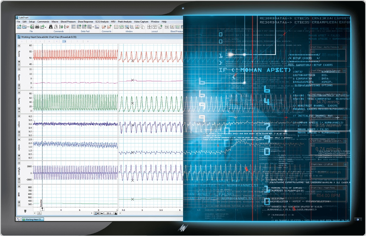 LabChart