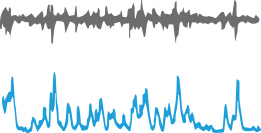 Sympathetic Nerve Activity Telemetry