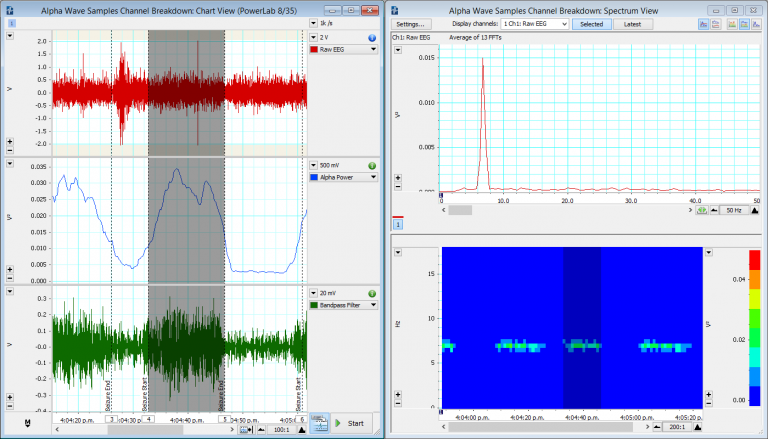 一个人暴露在光刺激下的脑电图记录。α波活度通过2种不同的方法进行分离:1)LabChart Spectrum和2)Bandpass Filter。